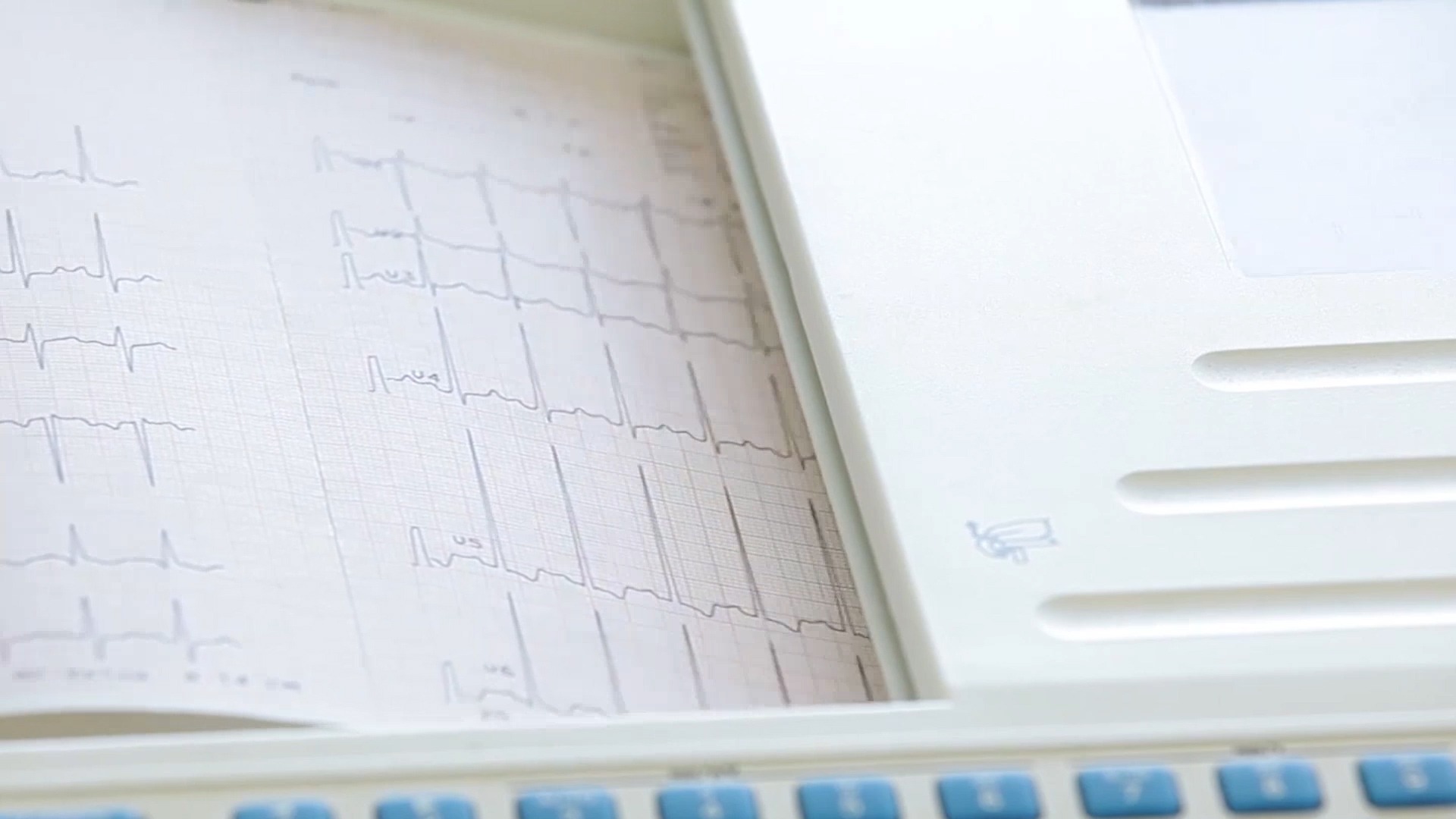 Značaj preventivnih pregleda u ranom otkrivanju kardiovaskularnih bolesti PORTAL 2